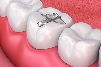 Schneider Family   Cosmetic Dentistry | Implant Dentistry, CBCT and Dental Cleanings