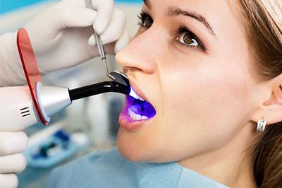 Schneider Family   Cosmetic Dentistry | Root Canals, Emergency Treatment and Dental Fillings