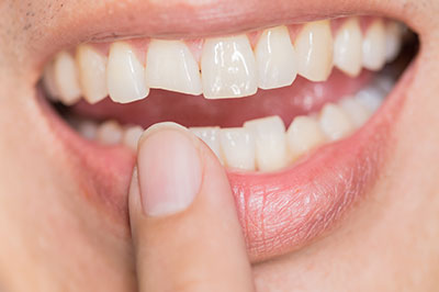 Schneider Family   Cosmetic Dentistry | CBCT, Sports Mouthguards and Full Mouth Reconstruction