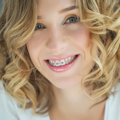 Schneider Family   Cosmetic Dentistry | Digital Radiography, Dental Bridges and Invisalign reg 