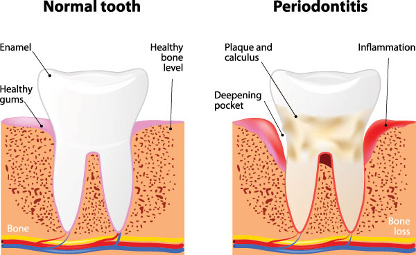 Schneider Family   Cosmetic Dentistry | Digital Radiography, ClearCorrect reg  and All-on-6 reg 