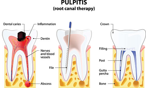 Schneider Family   Cosmetic Dentistry | Cosmetic Dentistry, Veneers and Implant Dentistry